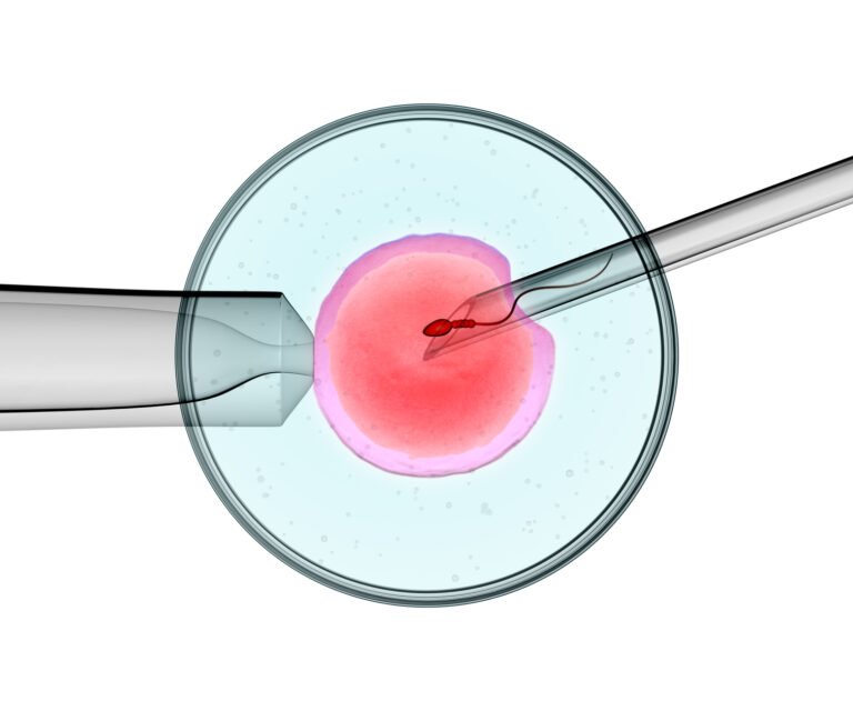 artificial insemination